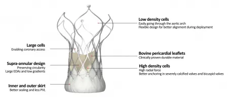 TRANSCATHETER AORTIC VALVE REPLACEMENT Vita Flow Visual 1 1